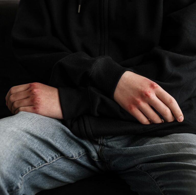 Autolisis: Cuando uno mismo se convierte en su peor enemigo